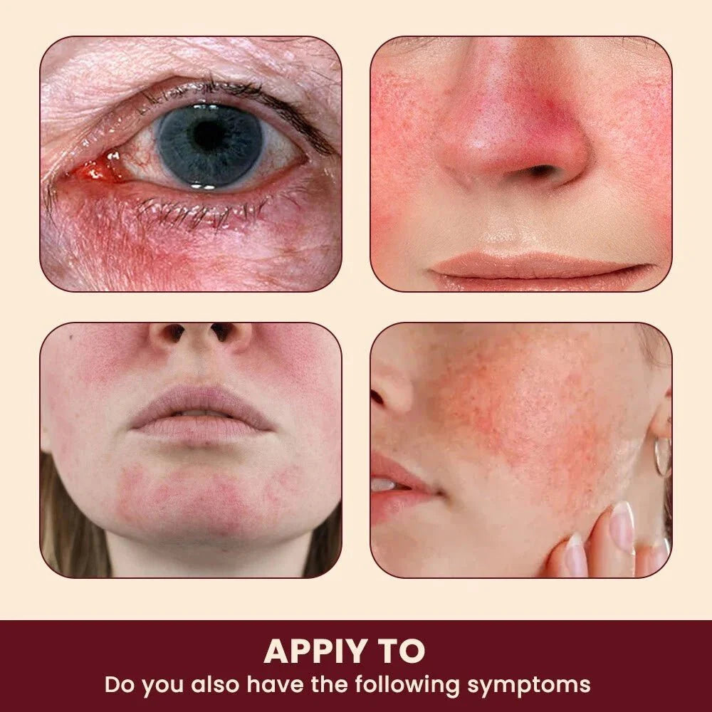 Collage of skin conditions on different parts of a face with text prompting for symptom assessment.