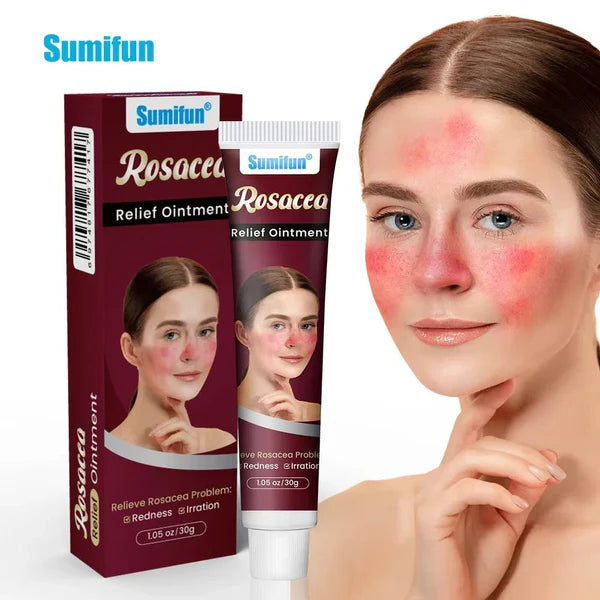 Sumifun Rosacea Relief Ointment packaging with a woman's face showing rosacea symptoms.