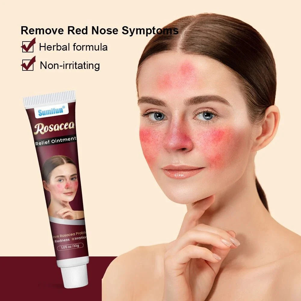 Woman with red nose symptoms and Sunter Rosacea Relief Ointment tube on beige background