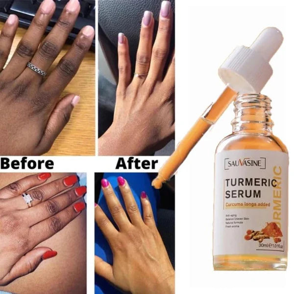Before and after comparison of hands with a bottle of Beauty Lights Turmeric Serum (Original).